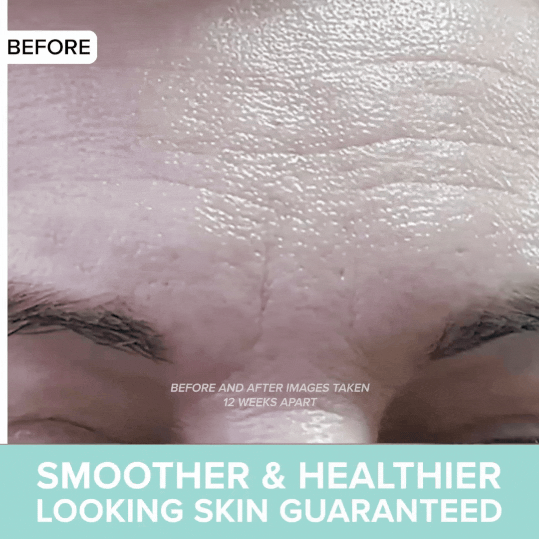 Smoother and Healthier Looking Skin Guaranteed