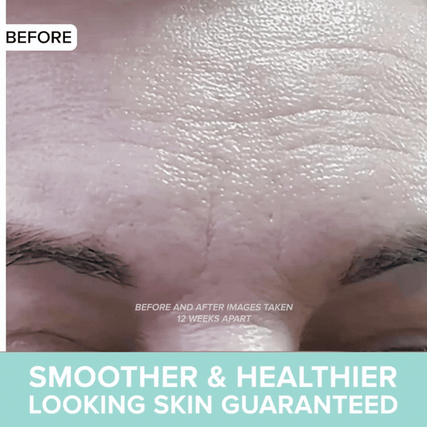 Smoother and Healthier Looking Skin Guaranteed